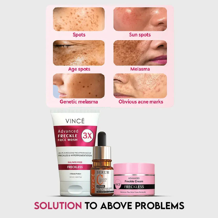 Freckle Challenge Kit